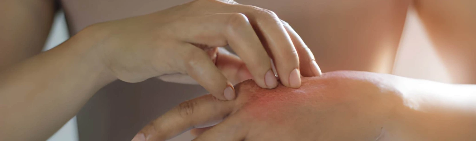 Expert Allergy Control Service hero image